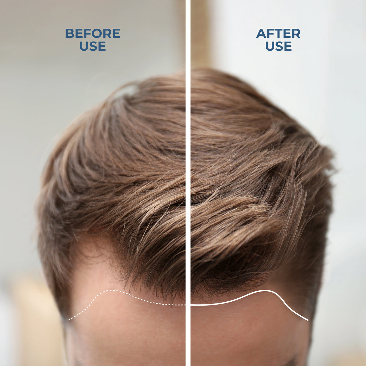 Framesi Reinforcing Activator 7 ml product image 2