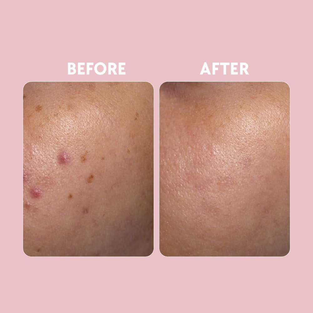 Posch Vitamin C Brightening Serum 30ml product image 8