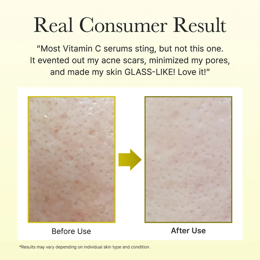 Arencia Face & Eye Moisturizer Cream Vitamin C Booster Shot 10ml product image 6