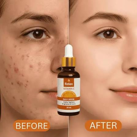 Relax Vitamin C Daily Serum - 30ml